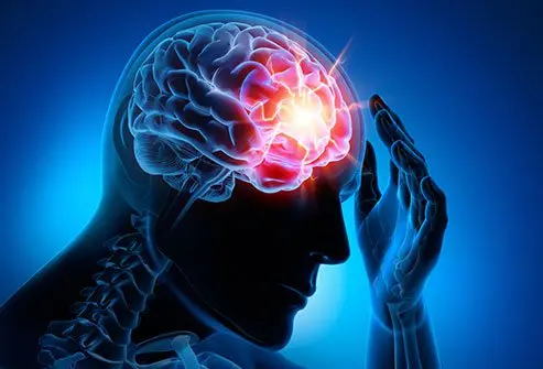 Long-term Effects of Concussions