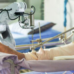 Robotic Joint Replacement