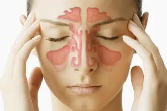Signs of Sinusitis