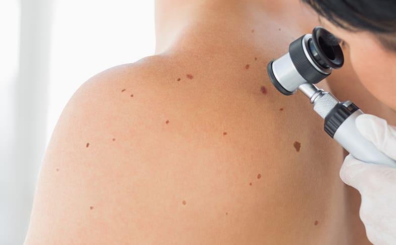 Skin Cancer Screening Appointment