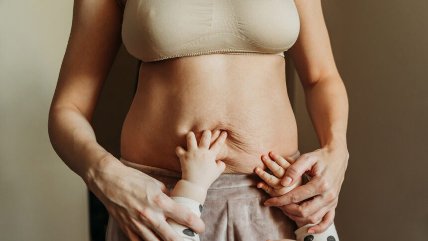 Transforming a Post-pregnancy Body