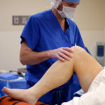 Knee Replacement