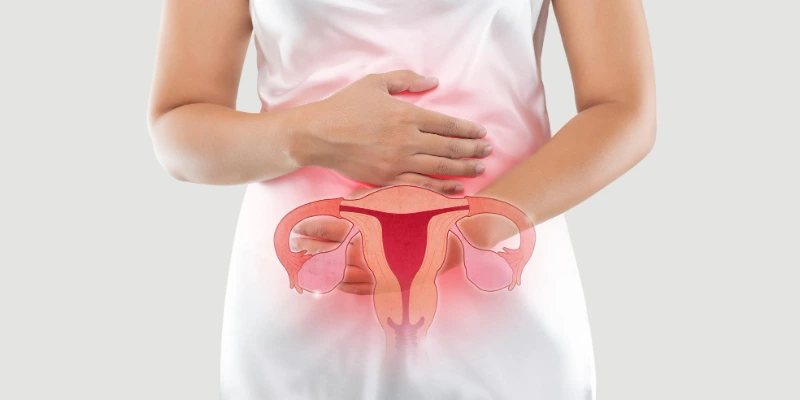 Link Between PCOS and Infertility